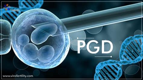 PGD